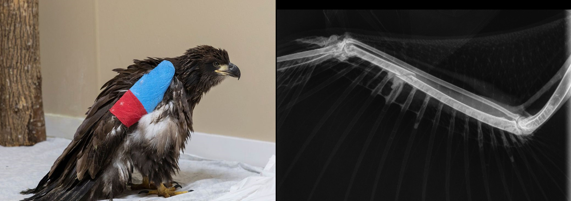 Eagle X-Ray and Cast